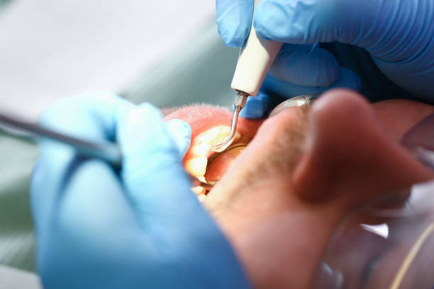 Best Emergency Treatment for Toothache in Alpha, NJ